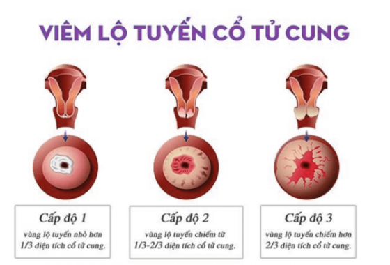 Thiết kế chưa có tên (23).png