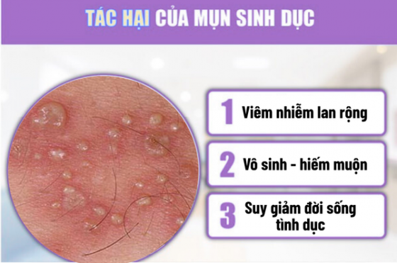 chua-benh-hieu-qua (49).png