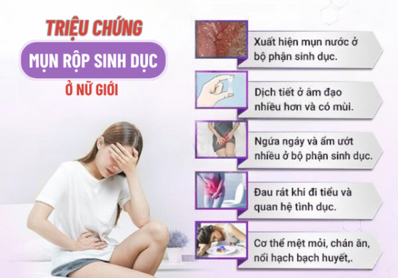 mụn rộp sinh dục.png
