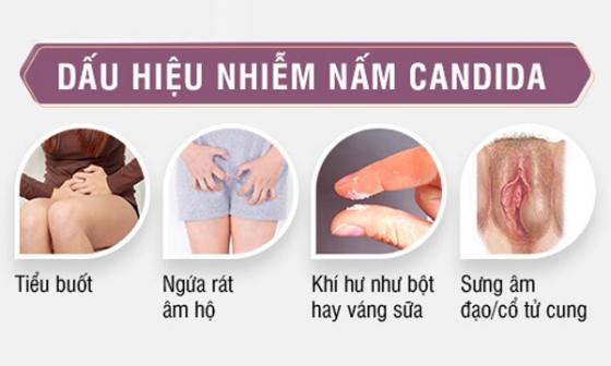 dau-hieu-nhiem-nam-candina-chi-em-nen-biet1.jpg