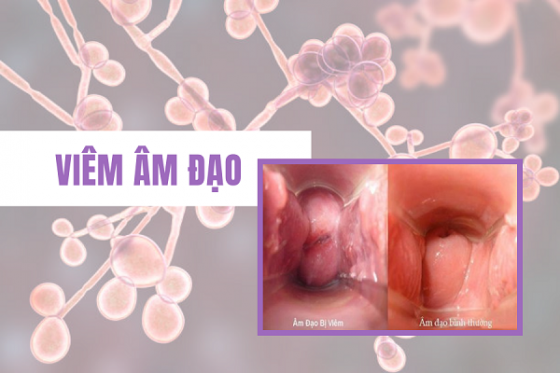 dieu-tri-benh-hieu-qua (95).png