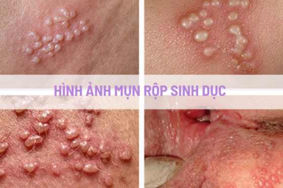 dieu-tri-benh-hieu-qua (96).png