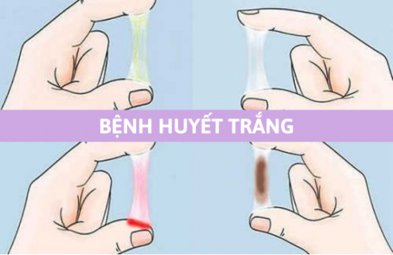 chua-benh-hieu-qua (84).png